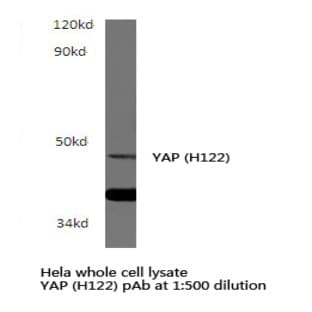 YAP (H122) pAb avatar