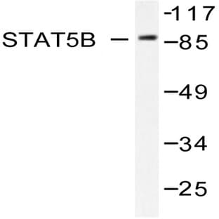 Stat5b (Y725) pAb avatar