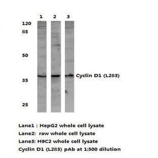 Cyclin D1 (L283) pAb avatar