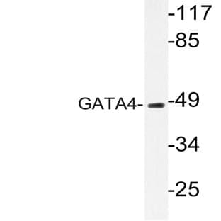 GATA4 (P101) pAb avatar