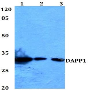 DAPP1 (E135) pAb avatar