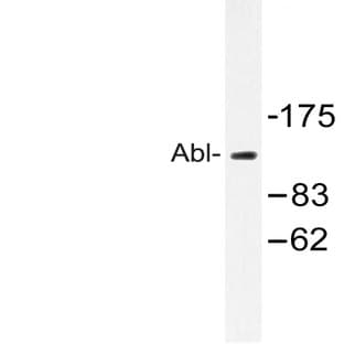 ABL1 (A198) pAb avatar