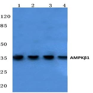 AMPK(beta)1 (V175) pAb avatar