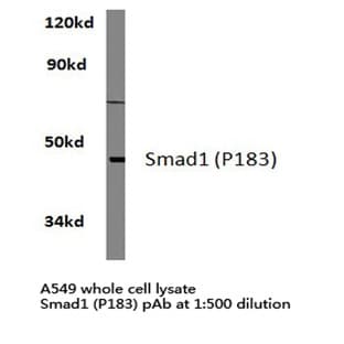 Smad1 (P183) pAb avatar