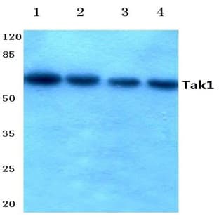 Tak1 (D181) pAb avatar