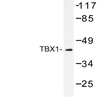 TBX1 (K347) pAb avatar