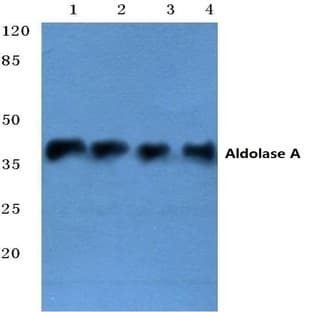 Aldolase A (T9) pAb avatar