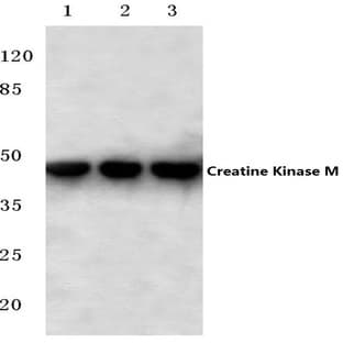 Creatine Kinase M (Y14) pAb avatar
