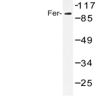 Fer (D798) pAb avatar