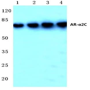 AR-(alpha)2C (R369) pAb avatar