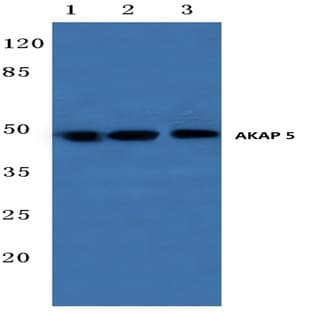 AKAP 5 (E7) pAb avatar