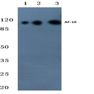 AF-10 (E237) pAb avatar