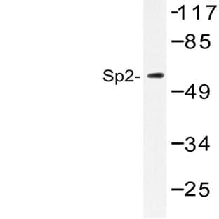 Sp2 (D512) pAb avatar