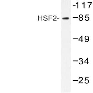 HSF2 (R432) pAb avatar