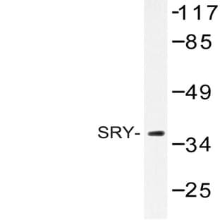 SRY (L80) pAb avatar