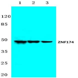 ZNF174 (E209) pAb avatar