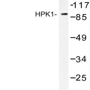 HPK1 (L397) pAb avatar