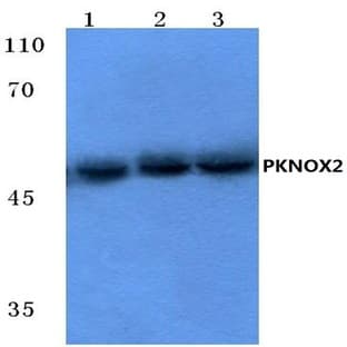 PKNOX2 (K361) pAb avatar