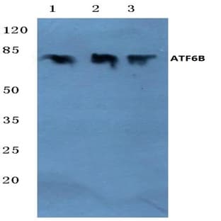 ATF6B (S425) pAb avatar