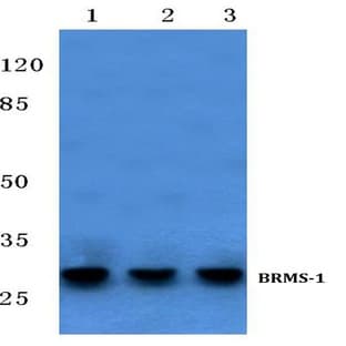 BRMS-1 (E43) pAb avatar