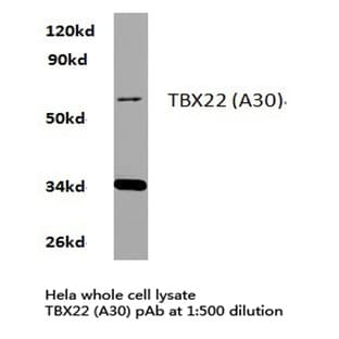 TBX22 (A30) pAb avatar