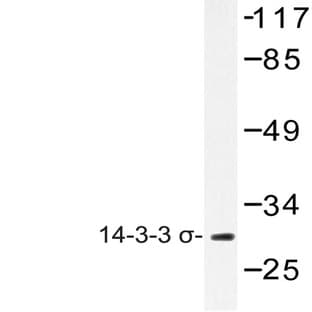 14-3-3 o (E66) pAb avatar