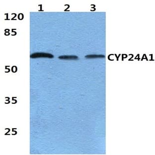 CYP24A1 (R439) pAb
