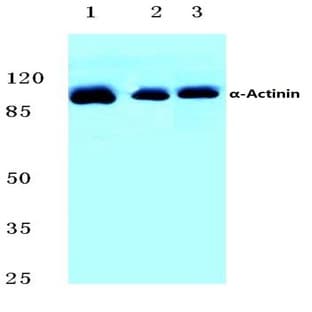 Actinin-(alpha)1/2/3/4 (W48) pAb avatar