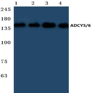 ADCY 5/6 (F1052) pAb avatar