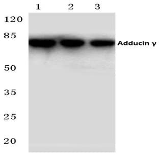 Adducin (gamma) (P452) pAb avatar