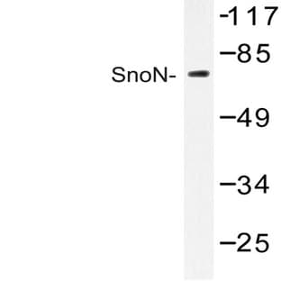 SnoN (D652) pAb avatar