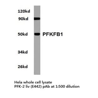PFKFB1 (E442) pAb avatar