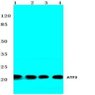 ATF3 (N159) pAb avatar