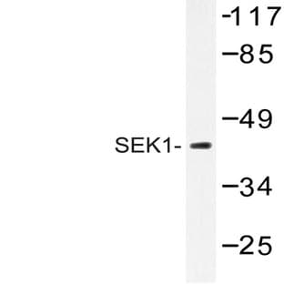 MEK-4/ MAP2K4 (K350) pAb avatar
