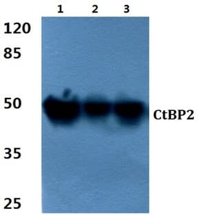 CtBP2 (P432) pAb avatar