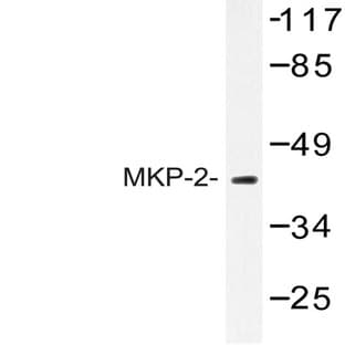 MKP-2 (Y108) pAb