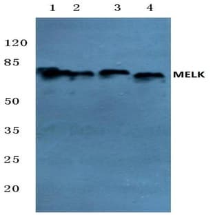 MELK (N449) pAb avatar
