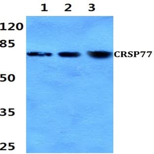 CRSP77 (V171) pAb avatar
