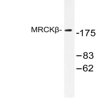 MRCK(beta) (F1665) pAb avatar