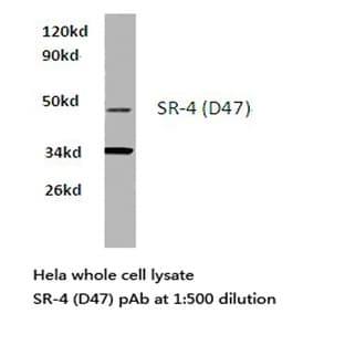 SR-4 (D47) pAb avatar