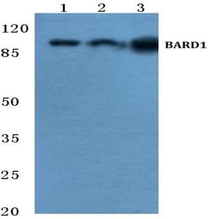 BARD1 (R8) pAb avatar