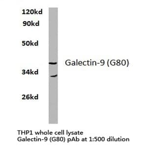 Galectin-9 (G80) pAb avatar