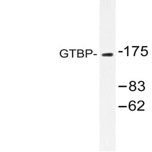 MSH6 / GTBP (E371) pAb avatar