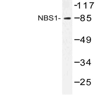 Nibrin / NBS1 (G274) pAb avatar