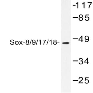 Sox8/9/17/18 (K148) pAb avatar