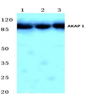 AKAP 1 (N306) pAb avatar
