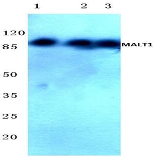 MALT1 (N324) pAb avatar