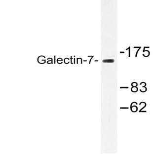 Galectin-7 (Q67) pAb avatar