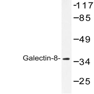Galectin-8 (N82) pAb avatar