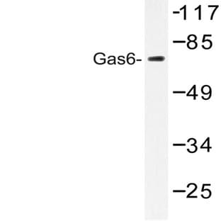 Gas6 (G309) pAb avatar